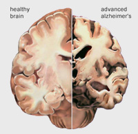 brain001.jpg